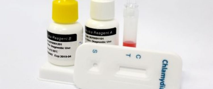 CHLAMIDIA Ag WITH POSITIVE CONTROL