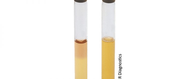 THIOGLYCOLLATE MEDIUM
