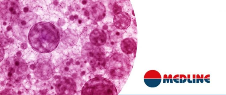 Identificazione microbica con MALDI-ToF: un passo avanti nella diagnostica delle infezioni