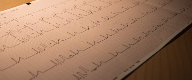 L’importanza dei marcatori cardiaci nella diagnosi delle malattie cardiovascolari