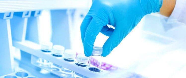Test diagnostici rapidi: cosa li distingue e come integrarli al tuo laboratorio